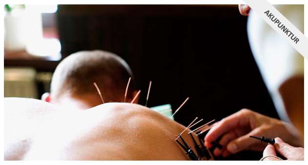 Akupunktur 